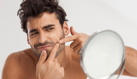 Men’s Acne- 5 Simple and Effective Tips to Get Rid of Acne and Scars ...